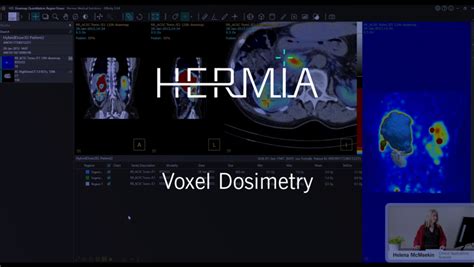 hermes solution|voxel dosimetry.